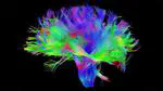 Talk “High Performance Computing in Neuroscience – a look at the Human Brain Project”